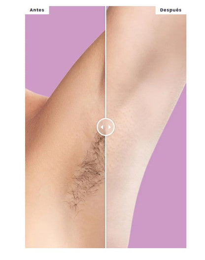 Depilación Suave y Cómoda