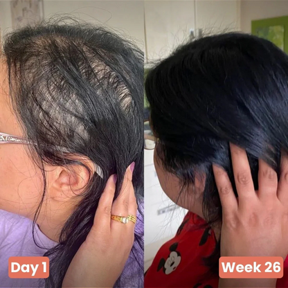 Sevich Hair Growth  Crecimiento Capilar Rápido 2x1